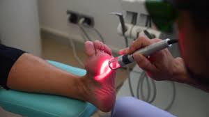 K-Laser for musculoskeletal pain in the foot and ankle 2 k laser pic